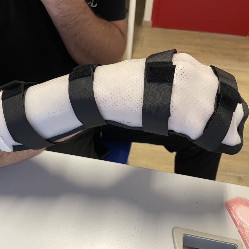 Poignet en flexion