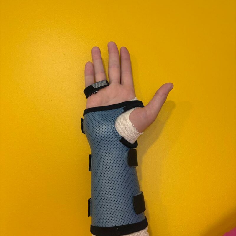 Repos poignet + syndactylie